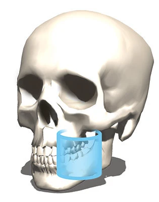 CBCT 5x5