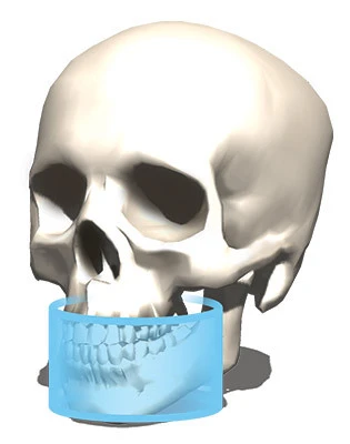 CBCT 6x8