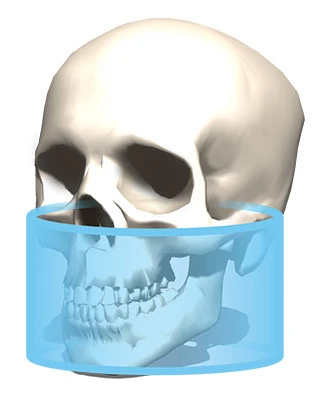 CBCT 8x15