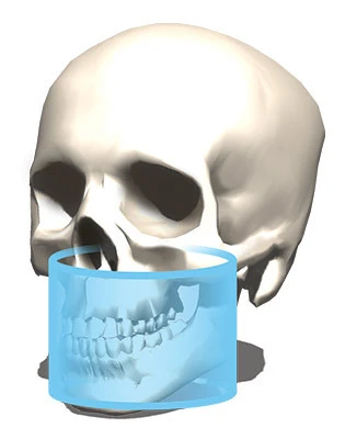 CBCT 8x8